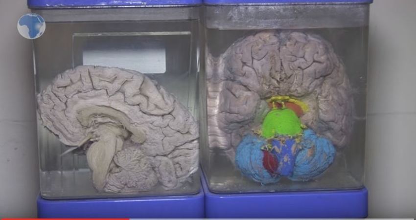 除了僵尸,就数他们对脑子最感兴趣了,平常的脑浆四溢