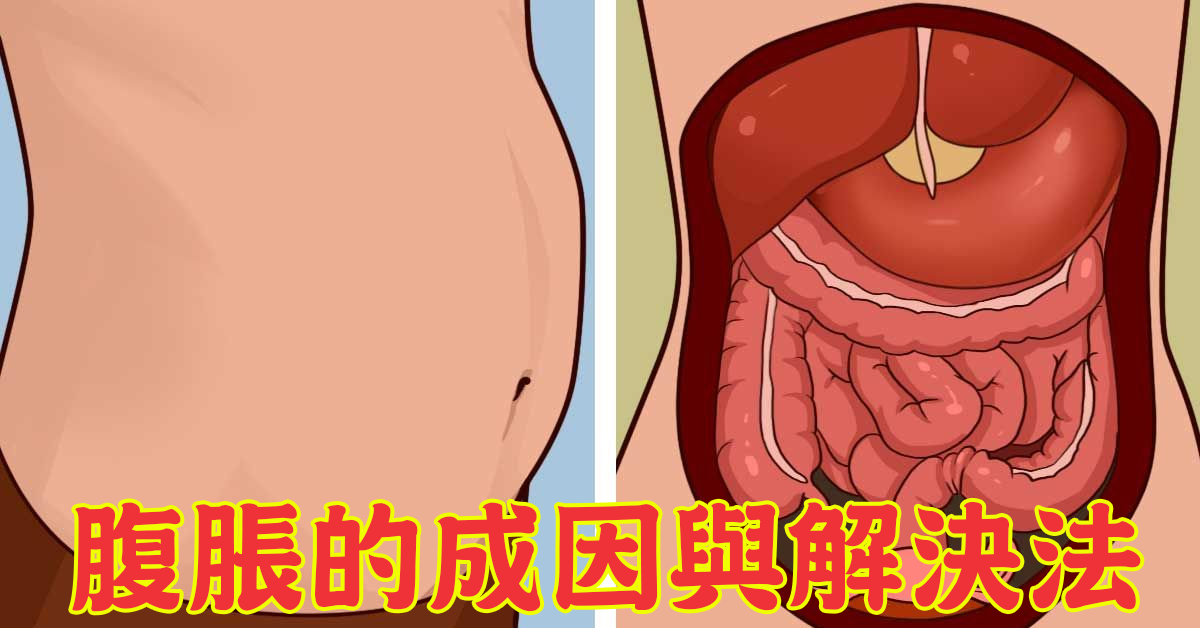 腹胀好困扰!了解造成腹胀的成因与解决法,让您不再「一肚子气」!