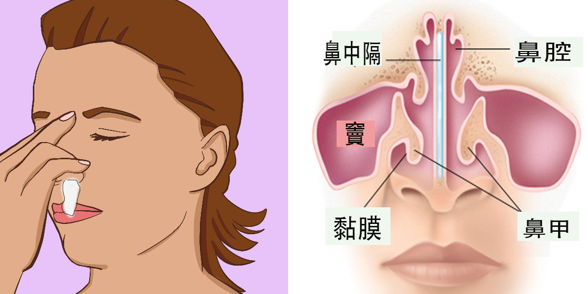 除了擤鼻涕「过度用力」还要注意哪些隐藏危机?