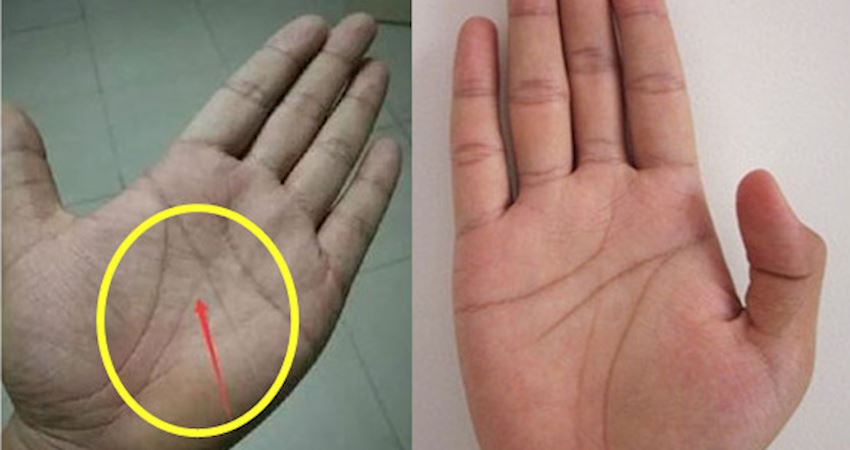 快看看你手掌上有没有这条「特殊掌纹」!若双手都有就